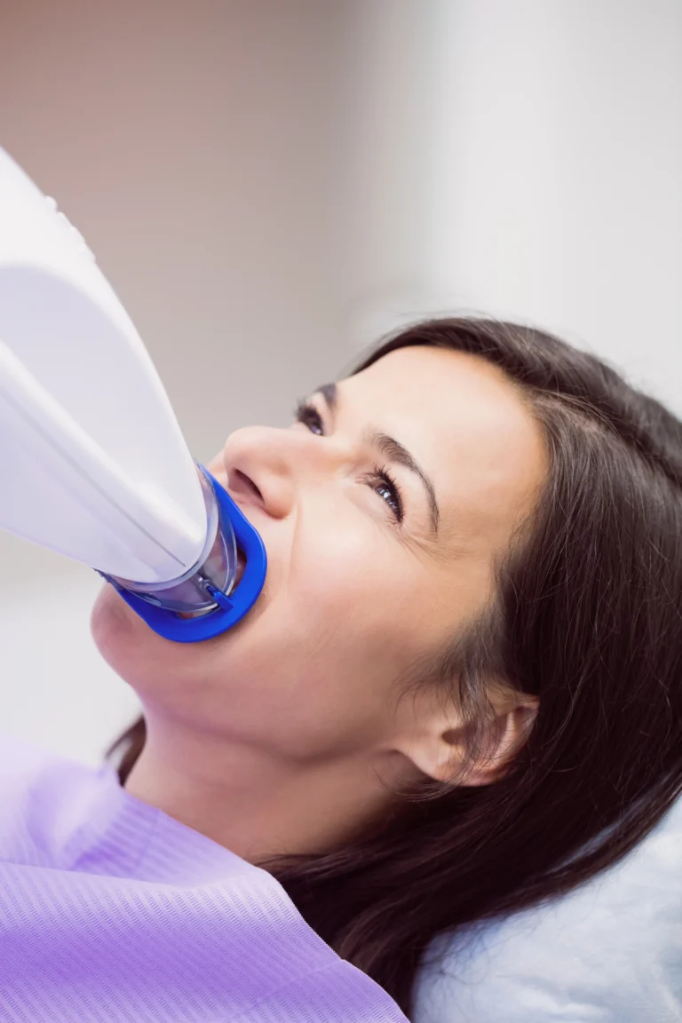 branqueamento dentário